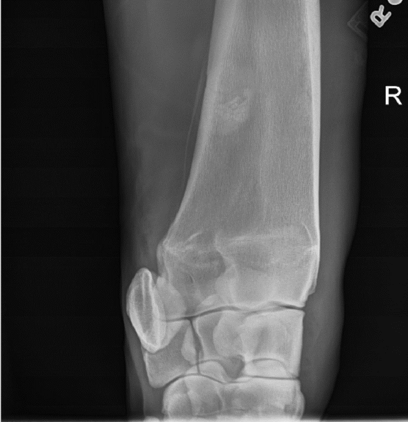 Initial-Xray-October-COTM.png