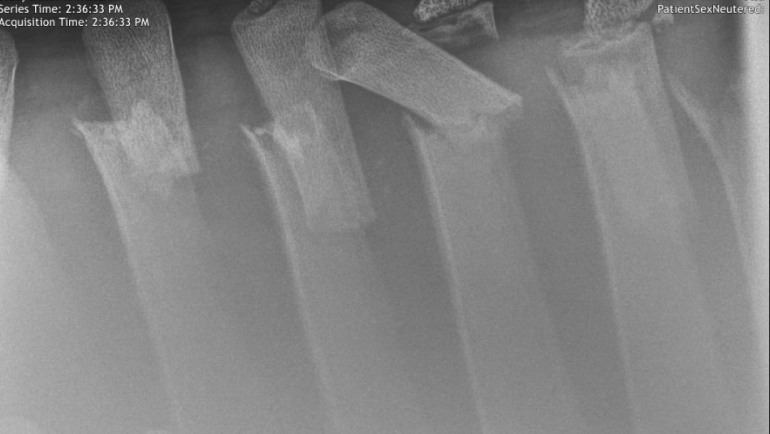 December: A Spine-Chilling Injury